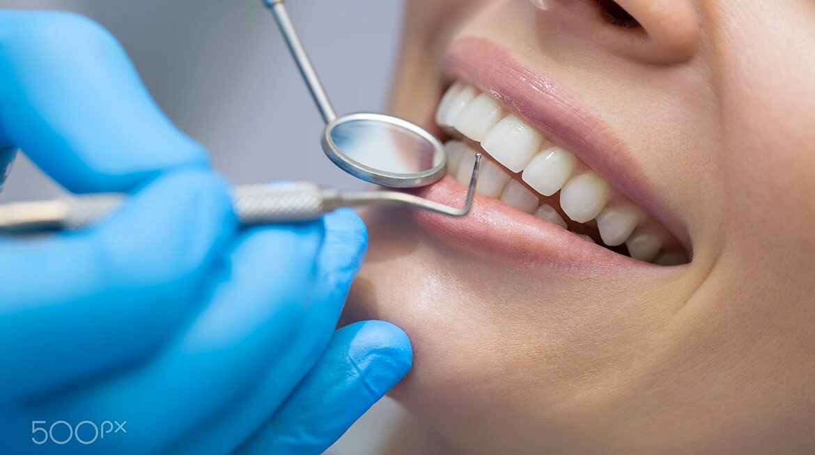 Cibi Sorprendenti che Sono In realtà Buoni per i Tuoi Denti