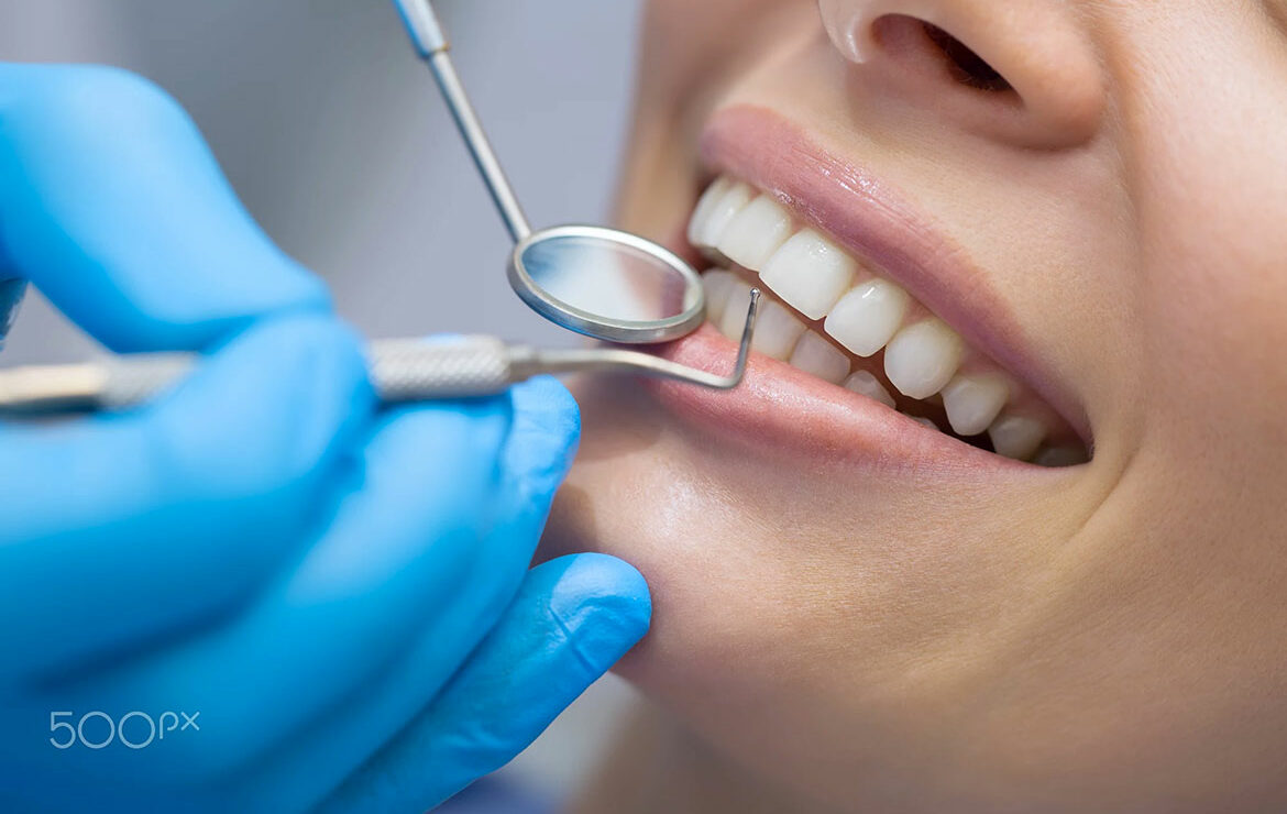 Cibi Sorprendenti che Sono In realtà Buoni per i Tuoi Denti